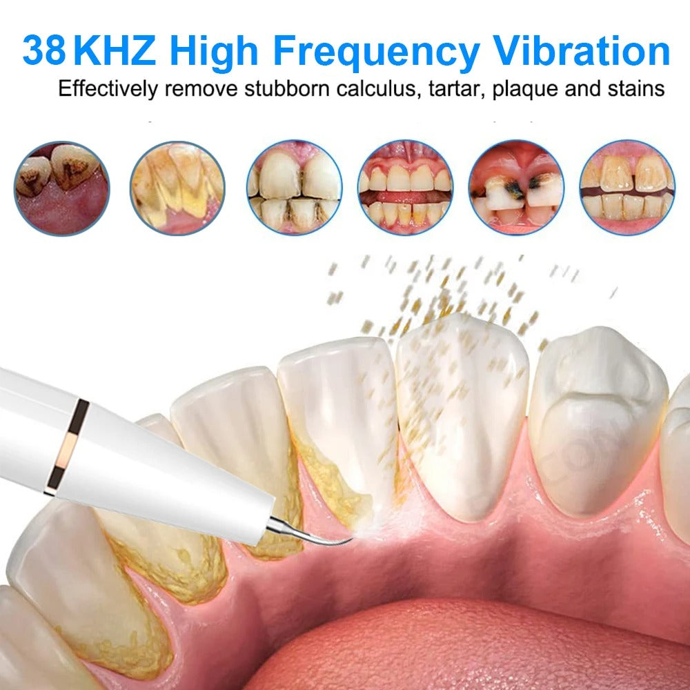Ultrasonic Plaque/Tartar Remover for Teeth, Dental Calculus Remover Teeth Cleaning Kit